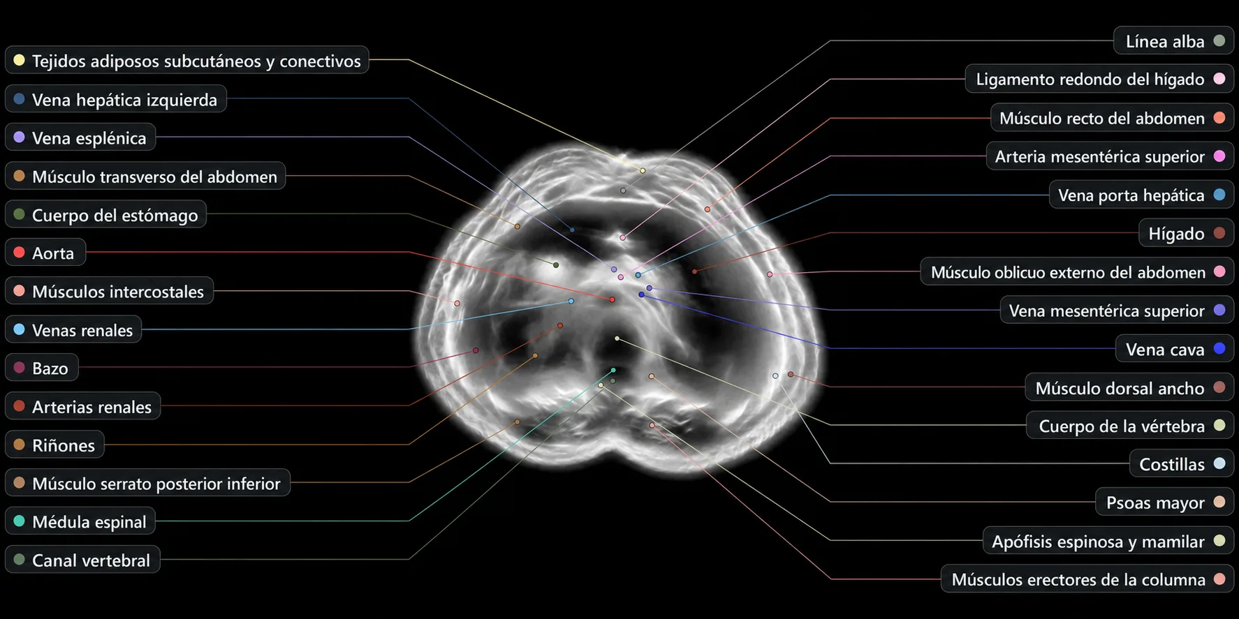 Corte transversal del abdomen reconstruido por el Midjourney Scanner, con etiquetas anatómicas en español: aorta, hígado, bazo, riñones, costillas, médula espinal y más.