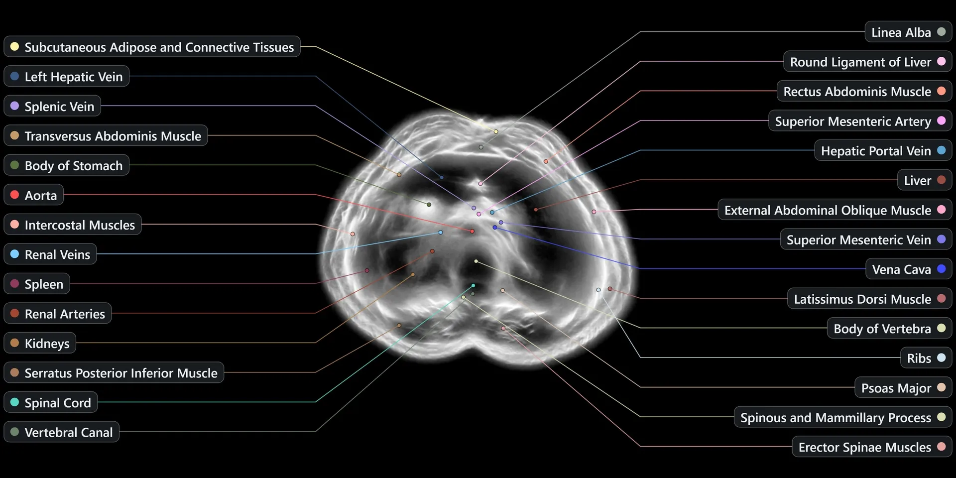 A wide ultrasonic reconstruction cross-section of a human upper abdomen produced by the Midjourney Scanner, showing soft-tissue structures.