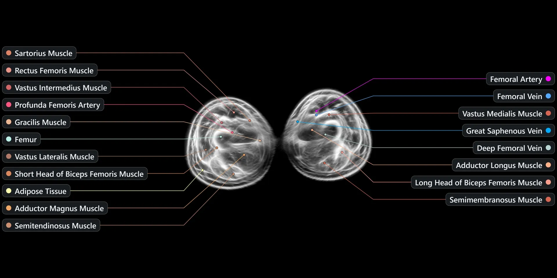 A wide ultrasonic reconstruction cross-section of a human thigh produced by the Midjourney Scanner, showing muscle and bone.